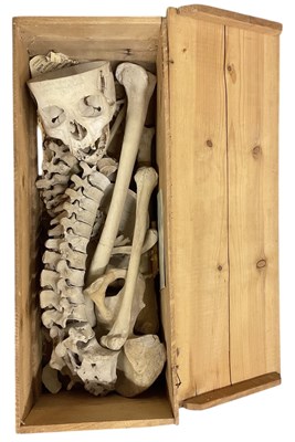 Lot 287 - An early 20th century medical human...