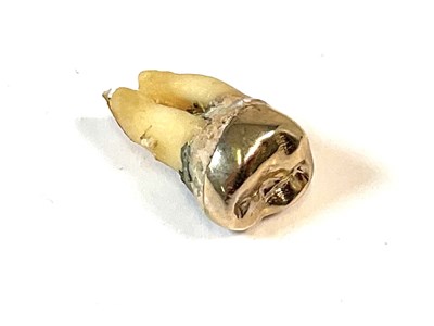 Lot 770 - A 'gold' capped tooth.