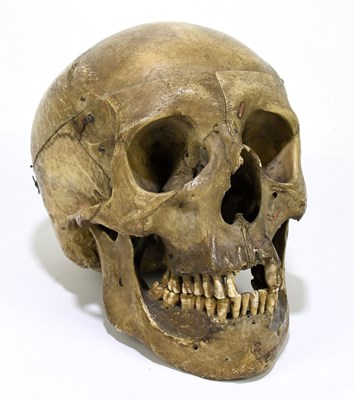 Lot 150 - A human skull for academic purposes.